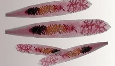 Opisthorchis parasitoak giza gorputzean