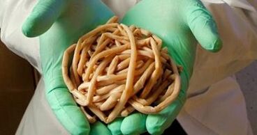 giza gorputzetik ateratako parasitoak