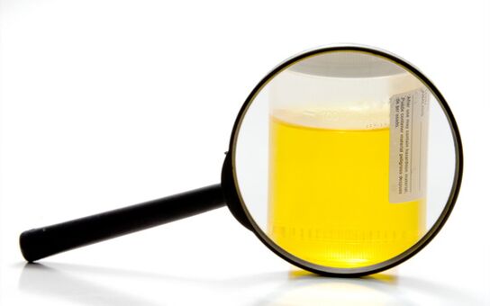 Eskistosomiasia diagnostikatzeko gernuaren azterketa