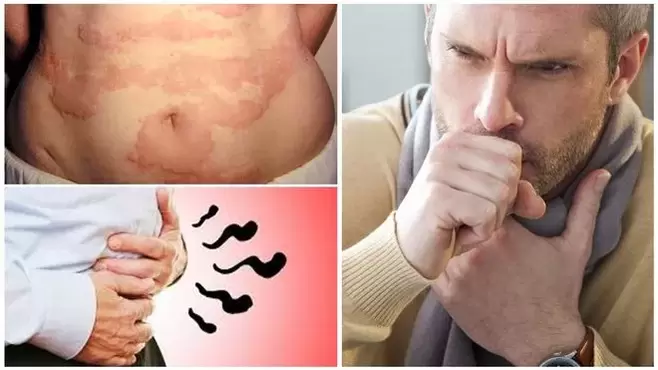 Alergiak, eztula eta puzketak zizareek gorputzean kalte egiten duten seinale dira