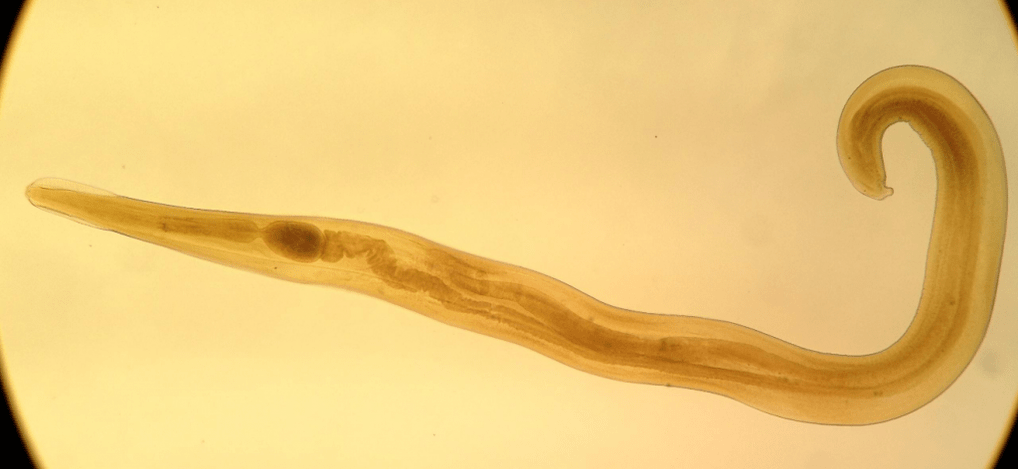 Pinworm ohiko parasitoa da haurren artean. 